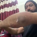 Army colonel and his son beaten up in Patiala