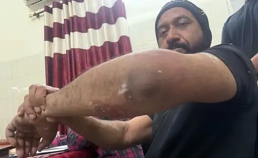 Army colonel and his son beaten up in Patiala
